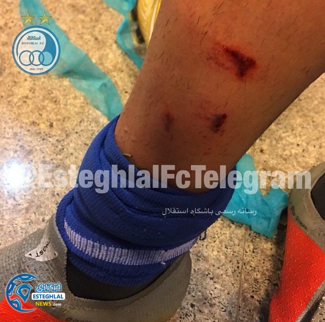 پای مصدوم صیادمنش