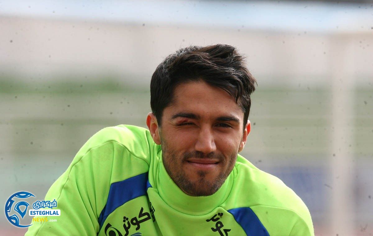 کبودی چشم حسین حسینی