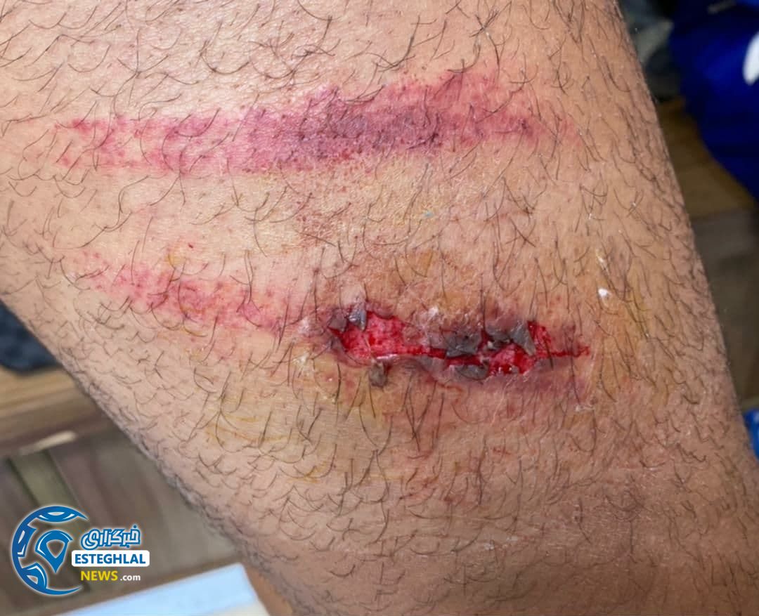 حواشی دیدار شهرخودرو و استقلال 