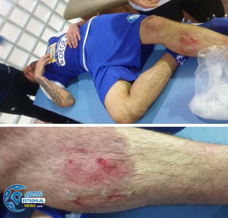 وضعیت پای دانشگر