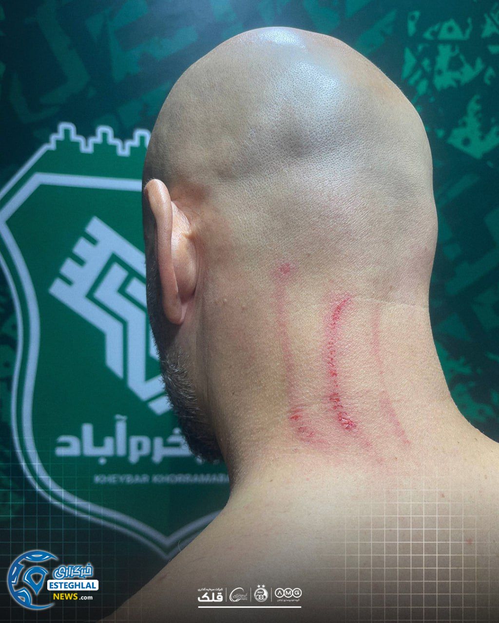 حواشی دیدار خیبر و استقلال 