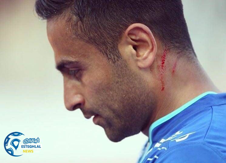 امید ابراهیمی